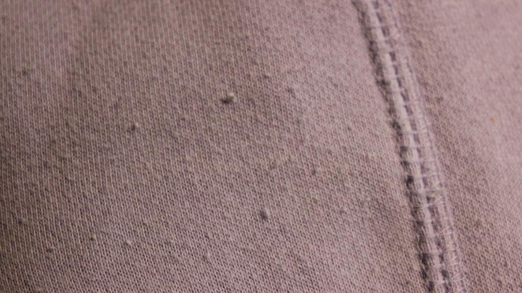 I have all this white stuff on my jacket. It's not lint because i have used  a roller and it doesn't come off. It's in the jacket a little. Like when I